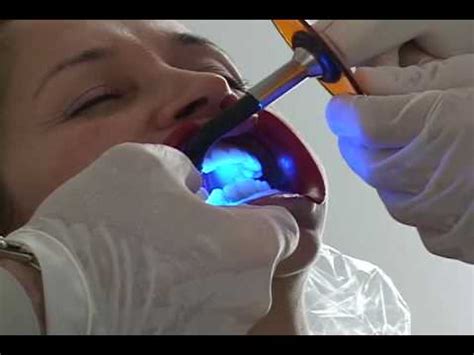 Explore the Wonders of Magical Tooth Whitening